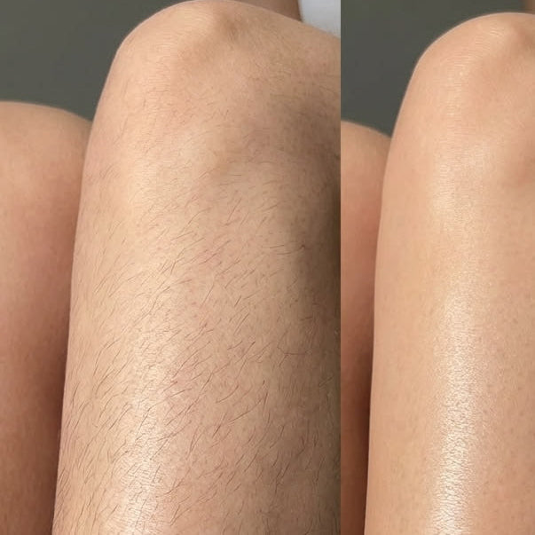 Hair Removal Mousse