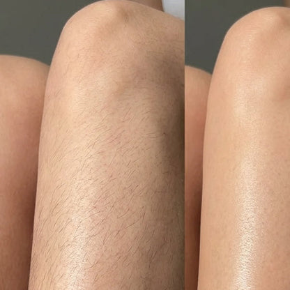 Hair Removal Mousse