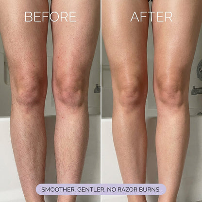 Hair Removal Mousse