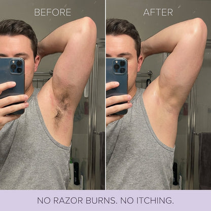 Hair Removal Mousse