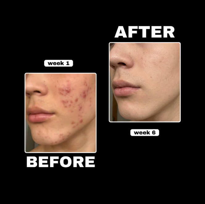 Copper Peptide Topical Serum (GHK-Cu)