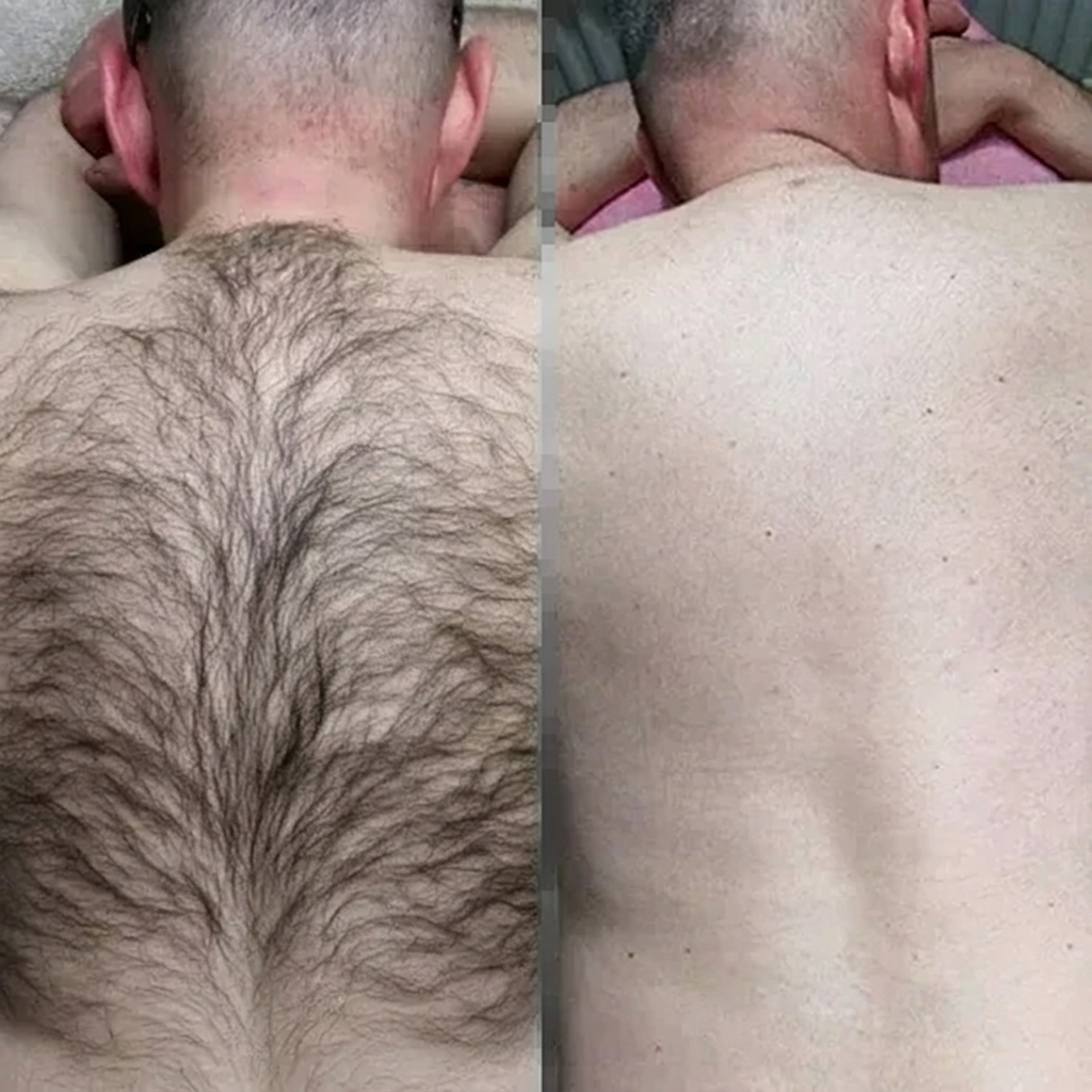 Hair Removal Mousse