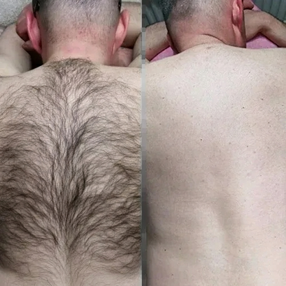 Hair Removal Mousse